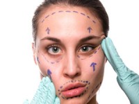 plastic-surgery, operacja plastyczna twarzy, lifting, calivita